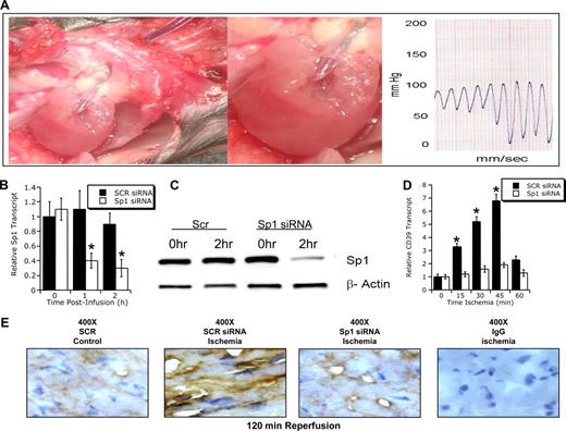 Figure 5. Influence of Sp1 siRNA siRNA in vivo on cardiac ischemia. (A) Murine model of in situ siRNA repression. A surgically inserted carotid catheter was advanced into the left ventricle. Blood pressure recording confirmed correct placement of the catheter tip within the left ventricle. After placement of the catheter's infusion port within the left ventricle, an infusion of target (Sp1 siRNA) or control siRNA (SCR) together with transfection agent (siPORT Amine; Ambion) was given over indicated time periods (1.5 μg siRNA/g body weight over indicated time periods). Changes in cardiac Sp1 transcript (B) or protein (C) after in vivo siRNA repression. C57BL/6 mice were treated with a left ventricular infusion (as described for panel A) of siRNA specific for Sp1 or SCR siRNR. After indicated time periods, hearts were excised, total RNA isolated, and Sp1 transcript levels were determined by real-time RT-PCR. Data were calculated relative to an internal housekeeping gene (β-actin) and are expressed as fold change compared with control (0 hour of siRNA infusion ± SEM at each indicated time, n = 6). (C) Western blot. (D) CD39 transcript of myocardial biopsies from the area at risk after Sp1 repression. C57BL/6 mice were treated with scrambled control siRNA (SCR siRNA) or Sp1-specific siRNA (Sp1 siRNA) via intraventricular infusion over 2 hours before exposure to in situ myocardial ischemia (0-60 minutes). Cardiac tissue from the area at risk was excised at indicated time points, flash-frozen, and CD39 transcript was determined by real-time RT-PCR. Data were calculated relative to internal housekeeping gene (β-actin) and are expressed as fold change compared with control (0 minutes of myocardial ± SEM at each indicated time, n = 6). *P < .05 compared to 0 hours (B,D). (E) C57BL/6 mice were treated with control (SCR siRNA) or Sp1-specific siRNA (Sp1 siRNA) via intraventricular infusion over 2 hours before exposure to in situ myocardial ischemia (45 minutes). Cardiac tissue from the area at risk was harvested after 120 minutes of reperfusion, sectioned, and stained using CD39 antibody. Cardiac tissue from sham-operated mice served as control (original magnification ×400). To control for nonspecific staining, IgG was used at identical concentrations and staining conditions as the target primary antibodies for CD39.