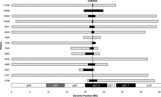 Figure 2. Diagrammatic representation of 15 biallelic deletions as assessed by array CGH analysis. The shaded bars represent the size of the monoallelic deletion; black bar represents the size of the biallelic deletion. The genomic location of CDKN2A is shown by the vertical line. A partial ideogram of chromosome 9p is shown at the bottom for reference.