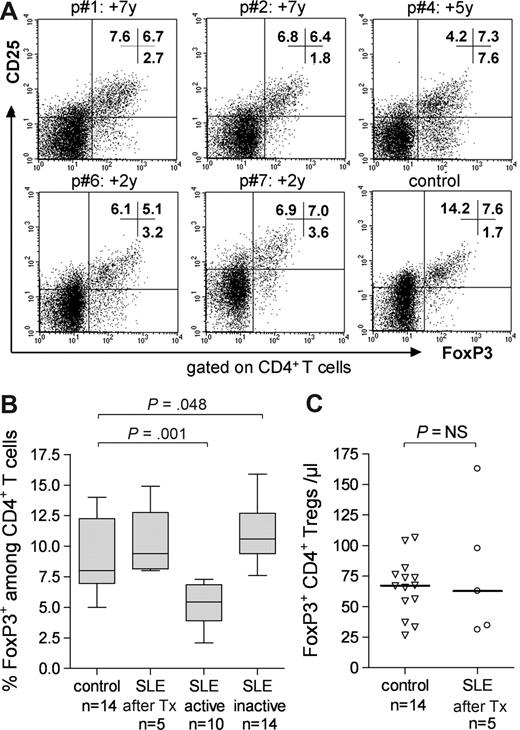 Figure 2. Phenotypic analysis of FoxP3+ Treg levels in 5 patients after ASCT compared with those in healthy controls and conventionally treated SLE patients. (A) CD25 and FoxP3 expression on CD4+ T cells at indicated times after ASCT in 5 patients and 1 control. (B) Median FoxP3 expression levels in CD4+ T cells (as determined by flow cytometry in panel A) in 5 patients versus 14 healthy controls, 10 conventionally treated patients with active SLE (SLEDAI ≥ 6), and 14 conventionally treated with inactive SLE (SLEDAI < 6). Group comparisons were performed using the Mann-Whitney U test. (C) FoxP3+ CD4+ Tregs (median absolute counts, as determined by flow cytometry in panel A) in 5 patients versus 14 normal controls. A Mann-Whitney U test was used for group comparison.