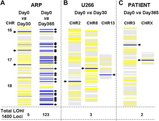 Figure 3. Acquisition of new genomic changes in multiple myeloma cells over time. Myeloma cells were cultured for various durations. Aliquots of cells were removed at specified intervals and genomic DNA was isolated and evaluated for LOH with the use of HuSNP chips (Affymetrix). DNA from the cells harvested and frozen at day 0 was used to define the allelotype baseline, departures from which identified new LOH loci in cells harvested at later time points. Blue lines show new LOH loci in the regions of genome indicated, whereas yellow lines represent retention of preexisting LOH sites. The numbers at the bottom of each figure indicate total number of new LOH loci throughout genome, per 1400 sites investigated. (A) New LOH loci in ARP myeloma cells cultured for either 1 or 12 months, in the region of genome spanning chromosomes 16, 17, and 18, are shown as an example. (B) New LOH loci in U266 myeloma cells cultured for 1 month. (C) New LOH loci in genomic DNA samples, derived from a patient at 1-year intervals.