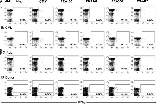 Figure 1. CD8+ T-cell responses defined by analysis of intracellular cytokine production. (A) AML patient 3. (B) CML patient 17. (C) ALL patient 23. (D) Healthy donor 34. PBMCs (106) were loaded with test peptides, and intracellular cytokine analysis for IFN-γ was performed as described in “Methods.” Plots are gated on CD3+ T cells. Numbers in the upper right quadrant represent the percentage of IFN-γ–producing CD8+ T cells.