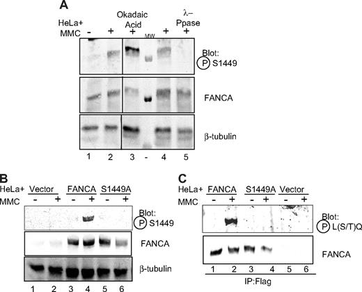 Figure 1. Phospho-FANCA serine 1449 is induced after DNA damage. (A) HeLa cells treated with 1 μM MMC for 18 hours (lanes 2-5) and 1 μM okadaic acid for 30 minutes (lane 3) were lysed, and 175 μg protein was subjected to SDS-PAGE and immunoblot for endogenous FANCA. In lanes 4 and 5, 275 μg protein from HeLa cells treated with MMC was treated directly with λ-phosphatase and run on SDS-PAGE. Proteins were immunoblotted using antiphosphoserine 1449 antibody. FANCA immunoblot shows even FANCA expression. β-tubulin shows equal loading. All lanes depicted are from the same gel, same exposure. (B) HeLa cells expressing Flag-tagged FANCA, Flag-FANCA (S1449A), or vector control were treated with MMC 1 μM for 18 hours, lysed, run on SDS-PAGE, and immunoblotted using the same antibodies as in panel A. (C) Cell lysates from cells in panel B were immunoprecipitated with anti-Flag antibody and subjected to SDS-PAGE and immunoblot using antiphospho-(Ser/Thr) ATM/ATR substrate antibody. IP indicates immunoprecipitation; Ppase, phosphatase; P-S1449, phosphoserine 1449; P-L(S/T)Q, phospho-leucine (serine/threonine) glutamine (ATM/ATR substrate); and MW, molecular weight marker.