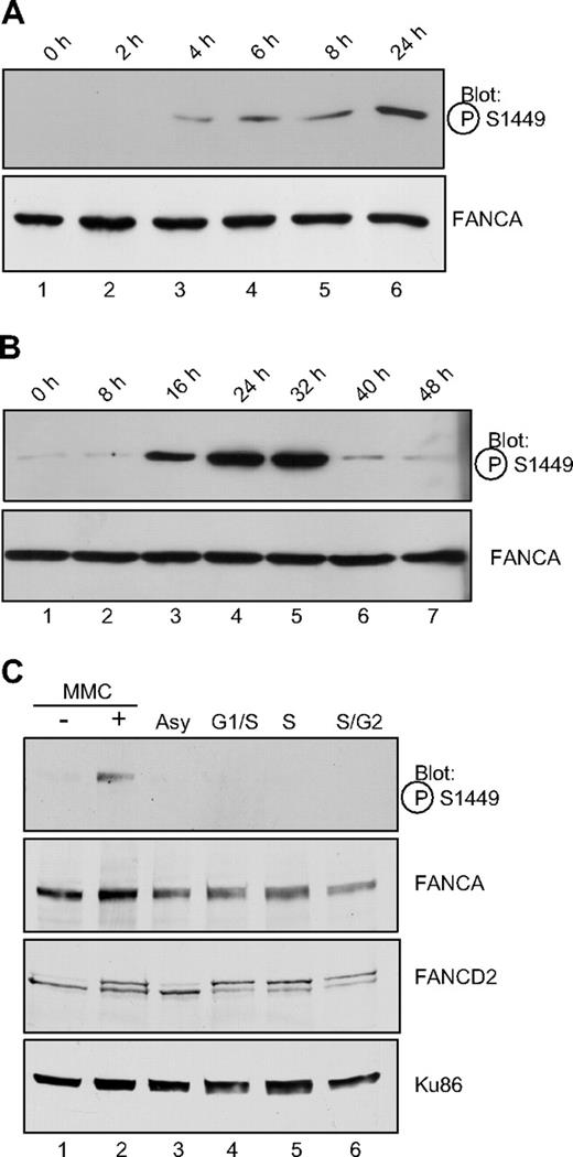 Figure 2. FANCA is induced after MMC treatment but is not phosphorylated during S phase. (A) Exponentially growing HeLa cells were treated with 1 μM MMC for the time indicated, before preparation of whole cell lysates and SDS-PAGE electrophoresis. Western blotting was performed with the phospho-specific or nonspecific antibodies to FANCA as indicated. (B) Conditions were as in panel A, with MMC treatment continued for the indicated time. (C). HeLa cells were synchronized by double thymidine block at the G1/S border (lane 4) and released for 3 hours into S phase (lane 5) or 6 hours into late S/G2 phase (lane 6). Alternatively, cells in lane 2 were treated with 1 μM MMC for 18 hours. Whole cell extracts were separated by SDS-PAGE and immunoblotted for phosphoserine 1449, FANCA, FANCD2, and Ku86 as a loading control. P-FANCA indicates phospho-FANCA.