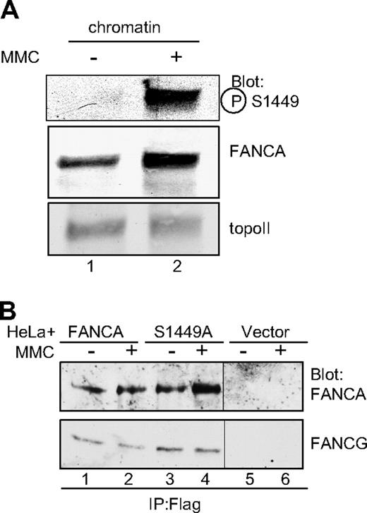 Figure 3. Phospho-FANCA S1449 is increased on chromatin after DNA damage and FANCA S1449A binds FANCG. (A) Chromatin extracts were prepared from HeLa cells treated with 1 μM MMC for 18 hours. Extracts were separated by SDS-PAGE and immunoblotted for phospho-FANCA S1449, total FANCA, and topoisomerase II as a loading control. (B) Whole cell extracts from HeLa cells expressing Flag-FANCA, Flag-FANCA S1449A, or the vector control and treated with 1 μM MMC for 6 hours were immunoprecipitated with anti-Flag. Immunoprecipitated proteins were separated by SDS-PAGE and immunoblotted for FANCA and FANCG. topoII indicates topoisomerase II; P-S1449, phosphoserine 1449; and IP, immunoprecipitation.