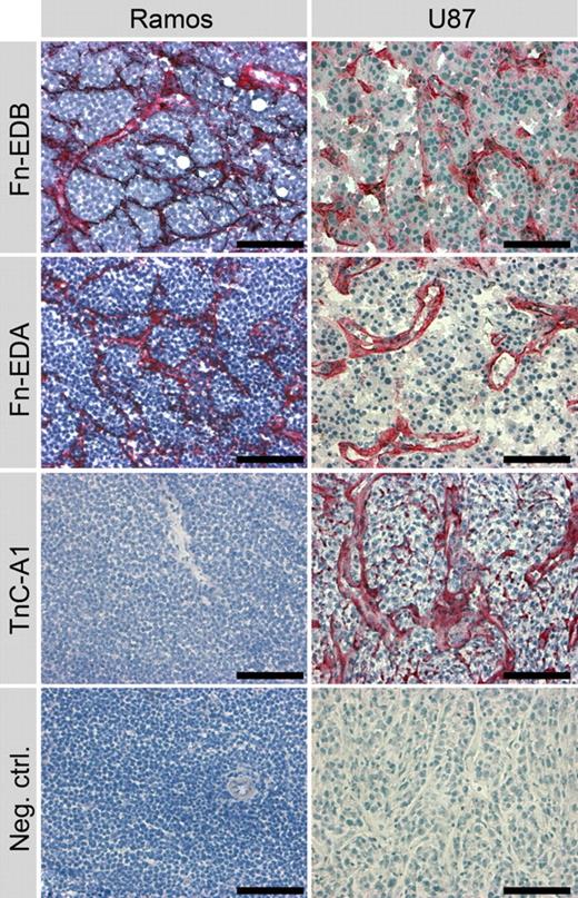 Figure 1. Immunohistochemistry with different monoclonal antibody fragments reveals EDB and EDA expression in B-cell lymphoma xenografts. Immunohistochemical stainings using the antibodies L19, specific to EDB fibronectin (Fn-EDB), and F8, specific to EDA (Fn-EDA), both well-established markers of neovascular structures in solid tumors, revealed a strong expression of these fibronectin isoforms with a prominent vascular pattern of staining in Ramos lymphoma xenografts (left panel). The staining is similar to the staining pattern of L19 and F8 in solid tumors, as exemplified with the U87 glioblastoma xenograft (right panel). In contrast, Ramos lymphomas were consistently negative for the large isoforms of tenascin C (using the antibody F16, specific to the domain A1 of human tenascin C, TnC-A1), whereas the glioblastoma displayed a positive staining in the same experiment. For negative controls, the primary antibody was omitted. Scale bars, 100 μm.