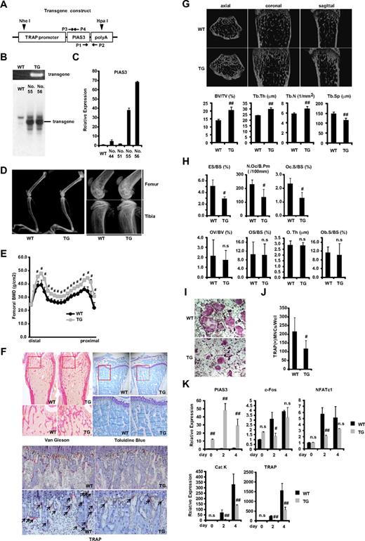 Figure 1. PIAS3-Tg mice show an osteopetrotic phenotype and impair osteoclast differentiation. (A) Schematic of the PIAS3 transgene construct containing the TRAP promoter followed by mouse full-length PIAS3 cDNA and poly(A) sequence. ▼ indicates a digestion site by HpaI and NheI for Southern blot analysis. →, ← indicate specific primers for genomic PCR (P1,2) and for generation of Southern blot probe (P3,4). (B) Genomic PCR with tail DNAs from WT and Tg mice (top). Southern blot of tail DNA from WT and PIAS3-Tg mice (bottom). (C) Expression of PIAS3 mRNA by real-time PCR. Total RNA was extracted from BMMs of WT and PIAS3-Tg mice for real-time PCR (right). (D) Radiologic analysis of long bones of TRAP–PIAS3-Tg mice and WT littermates. Right panel shows a maginified view of left panel. (E) Bone mineral density of 20 equal longitudinal divisions of femurs from 8-week-old WT and PIAS3-Tg mice. (F) Histologic analysis of long bone of PIAS3-Tg and WT (top left, Van Gieson; top right, toluidine blue; bottom, TRAP/hematoxylin staining). Arrows indicate the TRAP-positive mature osteoclasts. (G) MicroCT of axial, coronal, and sagittal sections of distal femoral metaphysis from representative 8-week-old PIAS3-Tg and WT. BV/TV (bone volume/tissue volume), Tb.Th (trabecular thickness), Tb.N (trabecular number), and Tb.Sp (trabecular separation) were analyzed by TRY/3D BON. (H) The parameters for osteoclastic bone resorption (ES/BS, N.Oc/B.Pm, and Oc.S/BS) and parameters for osteoblastic bone formation (OV/BV, OS/BS, O.Th, and Ob.S/BS) in the bone morphometrical analysis. ES/BS, eroded surface/bone surface; N.Oc/B.Pm, osteoclast number/bone perimeter; Oc.S/BS, osteoclast surface/bone surface; OV/BV, osteoid volume/bone volume; OS/BS, osteoid surface/bone surface; O.Th, osteoid thickness; Ob.S/BS, osteoblast surface/bone surface. (I) BMMs isolated from PIAS3-Tg and WT mice were cultured for 5 days with 30 ng/mL M-CSF and 50 ng/mL RANKL. Cultured cells were fixed and stained for TRAP. (J) TRAP-positive MNCs having more than 3 nuclei were counted as osteoclast. (K) Expression of PIAS3 and osteoclastogenic markers during RANKL-induced osteoclastogenesis. BMMs isolated from PIAS3-Tg and WT mice were cultured in the presence of 30 ng/mL M-CSF and 50 ng/mL RANKL for 0, 2, and 4 days. Total RNA was extracted from cultured cells, and real-time PCR was performed with primers specific for PIAS3, c-Fos, NFATc1, cathepsin K, and TRAP. Error bars in all panels represent standard deviation (SD). #P < .05; ##P < .01; n.s, not significant.