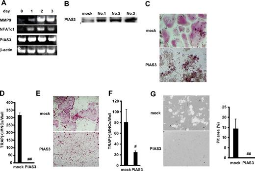 Figure 2. Overexpression of PIAS3 inhibits RANKL-mediated osteoclastogenesis in vitro. (A) Expression of MMP9, NFATc1, PIAS3, and β-actin mRNA. Total RNA from BMMs treated with 30 ng/mL M-CSF and 50 ng/mL RANKL for 0, 1, 2, and 3 days were measured by RT-PCR. (B) Western blot analysis of PIAS3 in RAW264.7 cells transduced with mock or PIAS3. (C) Analysis of osteoclast differentiation by TRAP staining. Mock- and PIAS3-transduced RAW264.7 cells were cultured for 3 days in the presence of 50 ng/mL RANKL. Cultured cells were fixed and stained for TRAP. (D) TRAP-positive MNCs having more than 3 nuclei were counted as osteoclast. (E) Analysis of osteoclast differentiation by TRAP staining. Mock- and PIAS3-transduced BMMs were cultured for 5 days in the presence of 30 ng/mL M-CSF and 50 ng/mL RANKL. Cultured cells were fixed and stained for TRAP. (F) TRAP-positive MNCs having more than 3 nuclei were counted as osteoclast. (G) Bone resorption assay using osteologic discs. Mock- or PIAS3-transduced RAW264.7 cells were cultured with 50 ng/mL RANKL on osteologic discs for 5 days. Pit area was quantified using ImageJ software. Error bars in all panels represent SD. #P < .05; ##P < .001.