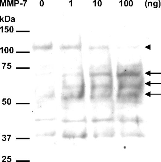 Figure 3. MMP-7 degrades human native sVEGFR-1 from endothelial cells. The supernatant of HUVECs was incubated with MMP-7 at the doses indicated. The digestion products were analyzed by SDS-PAGE and Western blotting using antibody against the extracellular region of VEGFR-1. ▶ indicates the putative band of full-length sVEGFR-1 that corresponds with the molecular mass of human native sVEGFR-1 from endothelial cells (110 kDa).16 → indicates the putative proteolytic fragments of sVEGFR1 from endothelial cells.