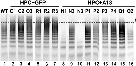 Figure 6. Plasma VWF multimer in transplanted mice. Plasma (2.5 μL) from wild-type (lane 1), Adamts13−/− mice expressing GFP (lanes 2-7 or O1-O3 and R1-R3) and full-length murine ADAMTS13 (lanes 8-16 or N1-N3, P1-P4, and Q1-Q2) at 2 months of age were fractionated by 1% mini-agarose gel electrophoresis. The VWF was determined by Western blot with anti-VWF IgG, followed by IRDye800-conjugated anti–rabbit IgG as described in “Assay for murine plasma VWF multimers.” The fluorescent signal was determined by an Odyssey infrared imaging system. Double stars indicate the area of UL-VWF multimers. All mice expressing murine ADAMTS13 exhibited reduced UL-VWF multimers.