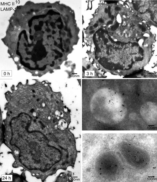 Figure 4. Immunoelectron microscopy analysis of pDCs during activation by flu. Ultrathin cryosections from pDCs exposed for 0, 3, or 24 hours to flu were prepared. Sections were then labeled using 10-nm and 15-nm immunogold particles for MHC II and LAMP-1 molecules, respectively. The 3 large sections of pDC presented (time 0, 3, and 24 hours) are electron microscopy images, which have been obtained using the Multiple Image Alignment function of the iTEM software (Eloïse; Electron Optics Instrument Service, West Orange, NJ). The 2 images on the bottom right show enlargements of typical MHC II+ compartments after 24 hours of flu exposure.