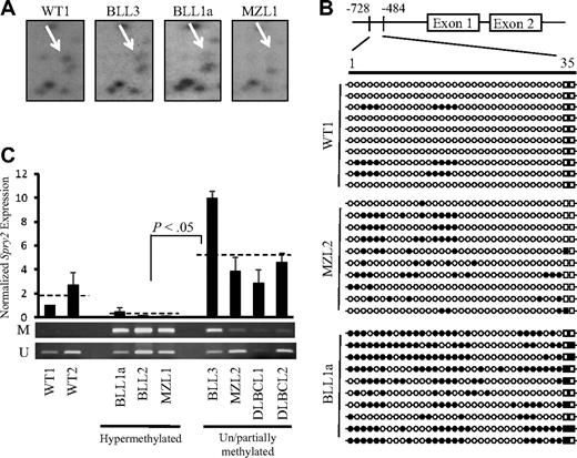 Figure 1. Spry2 is DNA-hypermethylated, and its expression is repressed in TCL1-tg B-cell lymphomas. (A) Spry2 RLGS locus (arrow) is shown for WT mouse spleen and 3 TCL1-tg B- cell tumors. Comparisons to the WT spot intensity scored BLL3 as unmethylated/partially methylated (> 50% of WT) and BLL1a and MZL1 as DNA hypermethylated (< 50% of WT) for the surveyed NotI site.14,40 (B) GBS of a CpG-rich region located between −728 and −484 in the mouse Spry2 promoter. Each row represents the sequence of an individual clone of WT spleen, MZL2, or BLL1a cells. ○, represents unmethylated CpG sites; ●, methylated sites; squares, 2 CpG loci within the Not1 site. (C) Spry2 expression in WT or TCL1-tg B-cell lymphomas was determined by quantitative PCR. Average Spry2 expression for each group (WT, hypermethylated, and unmethylated/partially methylated lymphomas) is shown by a dashed line. Spry2 expression was normalized to 36b4 (Rplp0) expression. DNA methylation status for WT or TCL1-tg B-cell lymphomas was also assessed by MSP. The top and bottom bands correspond to PCR products amplified by primers specific for methylated (M) or unmethylated (U) CpG sites after bisulfite conversion.