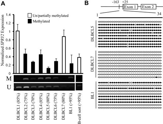 Figure 3. DNA methylation of the SPRY2 promoter is associated with reduced SPRY2 expression in patient lymphoma samples. (A) SPRY2 expression normalized to GAPDH expression was assessed by quantitative PCR in 7 DLBCLs and 1 BL, and the DNA methylation status for each tumor was assessed by MSP. The top and bottom bands correspond to PCR products amplified by primers specific for methylated (M) or unmethylated (U) CpG sites after bisulfite conversion. Estimated percentage of tumor cells in each sample is shown in parentheses. (B) GBS of a CpG-rich region located between −163 and +25 in the SPRY2 promoter in DLBCL5, DLBCL7, and BL1 patient samples. Each row represents the sequence of an individual clone. ○ represents unmethylated CpG sites; ●, methylated CpG sites.