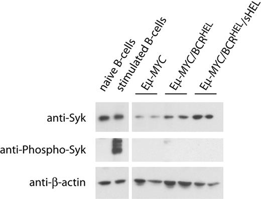 Figure 1. Syk expression and activity in NHL-like murine tumor B cells. Representative Western blot of naive and anti-IgM stimulated (5 minutes) wild-type B cells from spleen compared with 2 separate tumor spleens each from Eμ-MYC, Eμ-MYC/BCRHEL, and Eμ-MYC/BCRHEL/sHEL mice. Cells were lysed with 1% Triton X-100 in the presence of phosphatase and protease inhibitors, and blotted for anti–phospho-Syk (human Y525/526) (middle panel), stripped and reprobed for anti-Syk (top panel), and then stripped a second time and probed for anti–β-actin loading control (bottom panel).