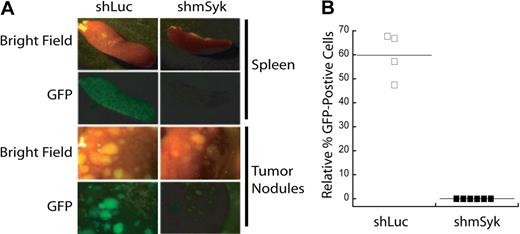 Figure 3. Syk-deficient lymphomas fail to expand in mice. DBL-114 tumor B cells were infected with either pLL3.7-shLuc or pLL3.7-shmSyk and then adoptively transferred into mice. Mice were killed when they developed externally palpable tumors (A). Representative brightfield or fluorescent images of tumor spleens and tumor nodules harvested from mice. (B) Quantitation of percent GFP+ cells left in tumors relative to the percentage of GFP+ cells transferred into the mice, as determined by FACS analysis of cells before adoptive transfer and after tumor harvest.