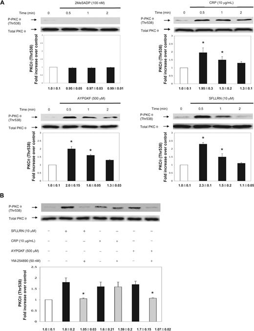 Figure 1. Activation of PKC-θ by different platelet agonists. (A) Washed and aspirin-treated human platelets were stimulated with 2MeSADP, collagen-related peptide (CRP), and PAR agonists SFLLRN (PAR1) and AYPGKF (PAR4) peptides with various times as indicated at 37°C. (B) Aspirin-treated, washed human platelets were stimulated with SFLLRN (10 μM) and AYPGKF (500 μM) peptides and CRP (10 μg/mL) in the presence or absence of Gq selective inhibitor YM-254890 (50 nm) at 37°C. The stimulation times for all agonists were 60 seconds. The samples were analyzed for threonine phosphorylation of PKC-θ by Western blotting using monoclonal phospho(Thr538)-specific PKC-θ antibody. Equal lane loading was assured by probing the samples with total PKC-θ in the same blot. The Western blot shown is representative of 3 experiments done from 3 different donors. Data were quantified by densitometry and analyzed the fold increase over control. *P < .05.