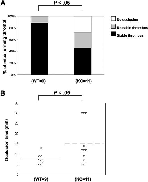 Figure 6. Role of PKC-θ in thrombus formation in vivo. Using the FeCl3 carotid artery injury model of in vivo thrombosis (2 minutes of exposure to 10% FeCl3), we analyzed the percentage of mice forming stable thrombi (A) and the average time of occlusion (B) in PKC-θ−/− and WT mice. PKC-θ−/− mice demonstrated prolonged average occlusion time (mean ± SEM; 15.7 ± 3.3 minutes) and a failure to form a stable thrombus versus littermates (7.6 ± 1.1 minutes of occlusion time; P < .05 by unpaired Student t test). Fisher exact probability test was used for analyzing data shown in panel A.