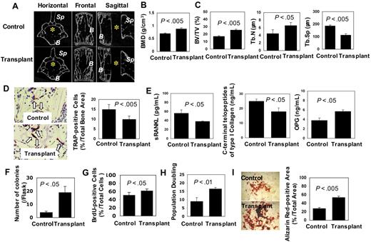 Figure 5. Subcutaneous transplantation of human BMMSCs rescues bone loss. (A) Micro-computed tomography analysis revealed that the third lumbar vertebra in transplant recipient mice (Transplant, lower panels) at 10 months after transplantation showed increase in trabecular bone volume compared with that of age-matched control mice (Control, top panels). B indicates vertebral body; Sp, spinosus process of vertebra. *Vertebral foramen. (B) Bone mineral density (BMD) of femurs in recipient mice (Transplant, n = 3) was significantly improved compared with age-matched controls (Control, n = 3), as assessed by dual X-ray absorptiometry analysis. Bars represent SD. (C) Bone morphologic analysis demonstrated increase in bone volume versus total volume (BV/TV) and trabecular number (Tb.N) and decrease in trabecular separation (Tb.Sp) in recipient mice (Transplant, n = 3) compared with the controls (Control, n = 3). Bars represent SD. (D) The number of TRAP-positive cells (arrows) decreased in the vertebral body of recipient mice (Transplant, n = 3) compared with control mice (Control, n = 3). Original magnification ×400. Bars represent SD. (E) ELISA assay revealed that serum sRANKL and C-terminal telopeptides type I collagen were decreased in recipient mice (Transplant, n = 3) compared with control mice (Control, n = 3). However, OPG was markedly increased in the recipient mice. Bars represent SD. (F) The number of CFU-F of BMMSCs derived from the recipient mice (Transplant, n = 3) increased compared with the age-matched control (Control, n = 3). Bars represent SD. (G) The proliferation of recipient BMMSCs (Transplant, n = 3) was significantly increased compared with the control group (n = 3), as determined by BrdU incorporation assay. Bars represent SD. (H) The population doublings of BMMSCs from recipient mice (Transplant, n = 3) were significantly increased compared with control mice (Control, n = 3). Bars represent SD. (I) Alizarin red staining showed that BMMSCs derived from recipient mice (Transplant, n = 3) had higher calcium accumulation than that from control mice (Control, n = 3) under osteogenic conditions. Bars represent SD.