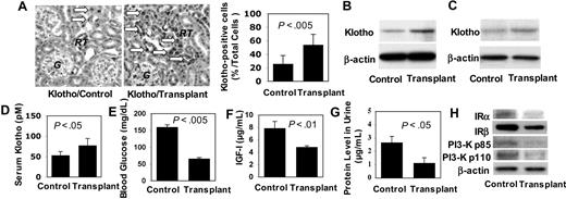 Figure 6. Subcutaneous human BMMSC transplantation up-regulated Klotho expression in immunocompromised mice. (A) Immunohistochemical staining with anti-Klotho antibody showed that transplant recipient mice (Transplant) expressed higher level of Klotho () in the epithelial cells of the renal tubules (RT) than those of age-matched controls (Control). G indicates glomerulus. Original magnification ×200. Bars represent SD. (B) Western blot analysis confirmed that Klotho was elevated in kidney of transplant recipient (Transplant, n = 3) compared with nontreated littermates (Control, n = 3). (C) Likewise, Western blot analysis showed elevated Klotho in brain of transplant recipient mice (Transplant n = 3) compared with the Control (n = 3). (D) ELISA assay further confirms elevated serum Klotho level in transplant recipient mice (Transplant, n = 3) compared with the control group (Control, n = 3). Bars represent SD. (E) Random blood glucose measurement showed decreased serum glucose in recipient mice (Transplant, n = 3) in comparison to control mice (Control, n = 3). Bars represent SD. (F) Similarly, serum IGF-I level was lower in recipient mice (Transplant, n = 3) compared with control mice (Control, n = 3). Bars represent SD. (G) Urine protein level was significantly decreased in recipient mice (Transplant, n = 3) compared with control mice (Control, n = 3). Bars represent SD. (H) Western blot analysis showed that expression of insulin receptor (IR) α, IRβ, phosphatidylinositol 3-kinase (PI3-K) p85, and PI3-K p110 was down-regulated in kidney tissues of transplant recipient mice (Transplant, n = 3) compared with control mice (Control, n = 3). β-Actin was used as protein loading control.