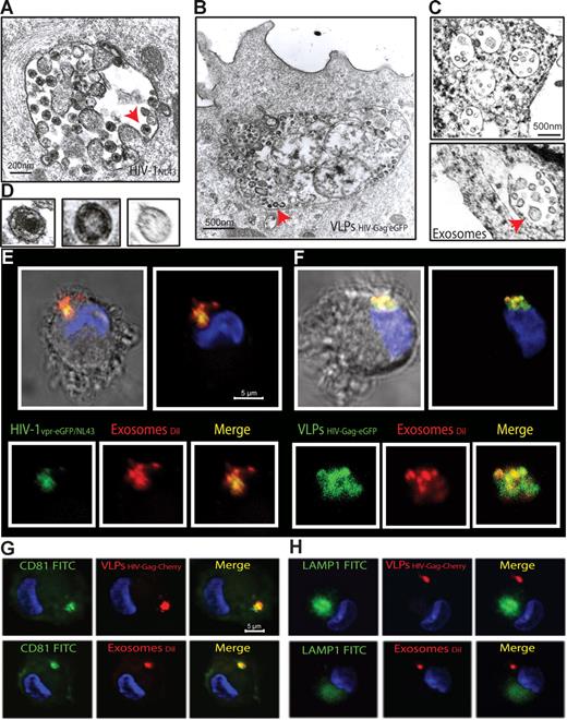Figure 3. mDCs retain HIV-1, VLPs and exosomes in the same CD81+ intracellular compartment. (A-C) Electron micrographs of mDCs sections exposed in parallel to HIVNL43, VLPHIV-Gag-eGFP, and ExosomesDiI, showing similar large vesicles containing these particles. Arrows indicate captured particles magnified in panel D, where comparative micrographs show, from left to right: HIVNL43, VLPHIV-Gag-eGFP, and a Jurkat-derived exosome. (E) Confocal images of a section of mDC exposed to HIVvpr-eGFP/NL43 and ExosomesDiI for 4 hours and stained with DAPI. Top images show the mDC, where the red and green fluorescence that merged with DAPI either with or without the bright-field cellular shape are presented. Bottom images show magnification of vesicles containing these particles where individual green and red fluorescence and the combination of both are depicted. (F) Confocal images of a section of a mDC exposed to VLPHIV-Gag-eGFP and ExosomesDiI as described in panel E. (G) Confocal images of a section of a mDC exposed to red fluorescent VLPHIV-Gag-Cherry (top) or ExosomesDiI (bottom) in parallel for 4 hours, fixed, and permeabilized to stain with DAPI and FITC-CD81. Images shown, from left to right, depict individual green and red fluorescence channels and the combination of both merged with DAPI. (H) Confocal images obtained as in panel G, except that cells were stained with DAPI and FITC-LAMP-1. mDCs retain VLPHIV-Gag-eGFP and ExosomesDiI in a CD81+ LAMP1− compartment.