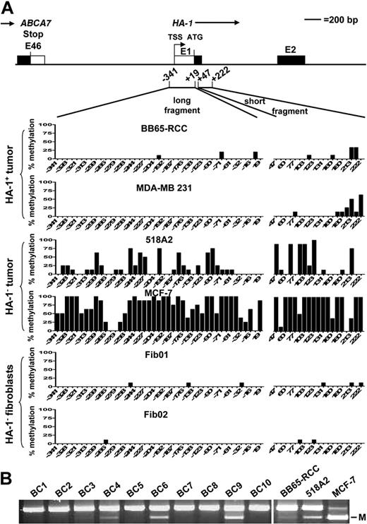 Figure 3. Analysis of the methylation status of the HA-1 promoter in cell lines and primary breast cancers. Genomic DNA extracted from various HA-1pos and HA-1neg tumor cell lines, fibroblasts, and primary breast cancers was subjected to sodium bisulfite treatment. (A) A long (−341 to +19) and a short (+47 to +222) DNA fragment were amplified by PCR and were subsequently analyzed by sequencing; y-axis indicates percentage of methylated cytosines in 7 to 10 independent DNA clones per cell line; x-axis, position of the CpG dinucleotides with respect to the ATG translation start site (+1). (B) COBRA of laser-microdissected primary breast cancer samples. BC1 to BC10 indicate invasive breast cancers; M, methylation.