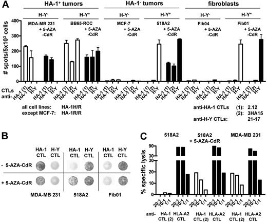 Figure 6. CTL recognition of HA-1neg tumor cells after 5-AZA-CdR treatment. (A) HA-1pos and HA-1neg tumor cells and fibroblasts (all HLA-A2pos) were treated with 100 μM 5-AZA-CdR for 8 days. Depicted is the response of the HA-1H–specific CTL clones 2.12 and 3HA15 and the H-Y–specific CTL clone 21-17 toward target cells before and after treatment with 5-AZA-CdR; y-axis indicates number of interferon-γ spots in the ELISPOT analysis per 5 × 103 cells. (B) Depicted are representative examples of the ELISPOT wells on coincubation of MDA-MB 231, 518A2, and Fib01 cells with the HA-1 CTL clone 2.12 and the H-Y CTL clone 21-17 before and after treatment with 5-AZA-CdR. (C) 518A2 tumor cells were treated with 1 μM 5-AZA-CdR for 8 days. Depicted is the lysis of 518A2 tumor cells by the HA-1H–specific CTL clone 3HA15 and the HLA-A2–specific CTL clone 1E2 before and after treatment with 1 μM 5-AZA-CdR for 8 days in a chromium release assay; x-axis indicates mean percentage of specific lysis (2 measurements per condition); y-axis, CTL clones each in 2 different effector/target ratios.