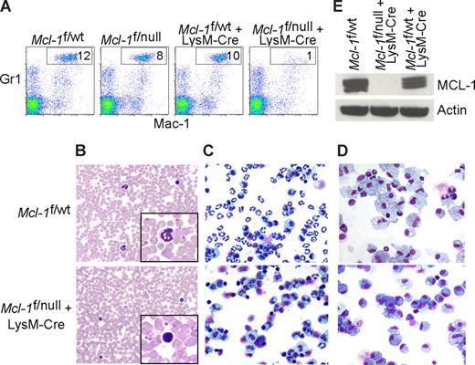 Figure 1. Myeloid-specific deletion of Mcl-1 results in neutropenia, but spares macrophages. (A) Flow cytometric analysis of peripheral blood from littermate control (Mcl-1f/wt, Mcl-1f/null, Mcl-1f/wt plus LysM-Cre) and myeloid lineage specific Mcl-1–deleted mice (Mcl-1f/f plus LysM-Cre) stained for Mac-1 (CD11b) and Gr1. Gate (Mac-1+Gr1high) indicates the percentage of mature segmented neutrophils in white blood cells. (B) Representative Wright-Giemsa–stained blood smears from littermate control and Mcl-1–deleted mice (20× objective). Insets depict expanded 100× objective view. (C,D) Stained cytospins of peritoneal exudate from littermate control (Mcl-1f/wt) and Mcl-1–deleted mice (Mcl-1f/null plus LysM-Cre) (C) harvested 16 hours after intraperitoneal injection of casein to induce neutrophil recruitment (images taken with 20× objective) or (D) harvested 5 days after intraperitoneal injection of thioglycollate to induce macrophage recruitment (images taken with 40× objective). (E) MCL-1 protein levels as determined by immunoblot analysis of BMDMs from control mice (Mcl-1f/wt and Mcl-1f/wt plus LysM-Cre) or from Mcl-1–deleted mice (Mcl-1f/null plus LysM-Cre). Blots were probed for actin expression to serve as a loading control.