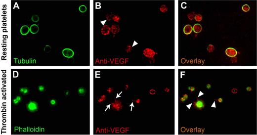 Figure 3. VEGF localization in resting and activated platelets. Double-label immunofluorescence microscopy on fixed and permeabilized platelets was used to determine the intracellular localization of VEGF in the resting and activated states. In resting platelets, tubulin is concentrated, as expected, in the marginal microtubule band (A). In thrombin-activated platelets, phalloidin stain confirms the morphologic changes expected with activation (ie, the development of filopodia, lamellipodia, and pseudopodia) (D). The VEGF stain labels punctate, vesicle-like structures distributed throughout the platelet cytoplasm in both resting (arrowheads in panel B) and activated platelets (E), consistent with the lack of release of VEGF on activation, as noted in Figure 2. In the activated state, VEGF is redistributed to filopodia and lamellipodia (arrows in panel E and arrowheads in panel F) in contrast to its granular pattern of distribution in resting state (C).