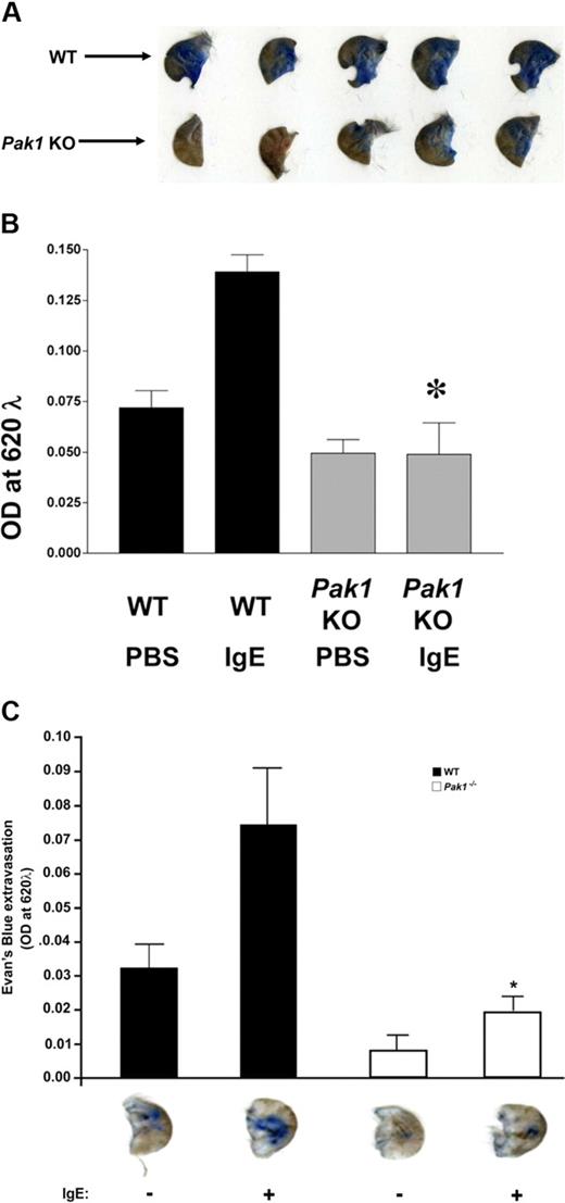 Figure 6. Genetic disruption of Pak1 diminishes PCA in vivo. Evans blue extravasation after antigen challenge. (A,B) Pak1−/− or WT mice (n = 5 genotype) were sensitized by intradermal injection of anti-DNP IgE (1:44 dilution, 1 μg/mL) into the right ear and with PBS into the left ear. After 20 hours, mice were challenged by intravenous injection of antigen (DNP-HSA) in PBS/Evans blue. IgE-primed (right) ears 30 minutes after antigen challenge are shown qualitatively (bottom). From each ear, Evans blue was extracted and the intensity of the dye was measured by absorption at 620 nm. *P < .05, WT versus Pak1−/−, unpaired, 2-tailed, Student t test. (C) Mast cell–deficient Wsh/Wsh mice (n = 5) were reconstituted locally in the ears by intradermal injection of WT or Pak1−/− mast cells. The mice were then sensitized by intradermal injection of anti-DNP IgE into the right ear and with PBS into the left ear as in panel A. IgE-primed (right) ears from mice reconstituted with WT or Pak1−/− mast cells 30 minutes after antigen challenge are shown qualitatively (bottom). From each ear, Evans blue was extracted and the intensity of the dye was measured by absorption at 620 nm. *P < .05, WT versus Pak1−/−, unpaired, 2-tailed, Student t test.