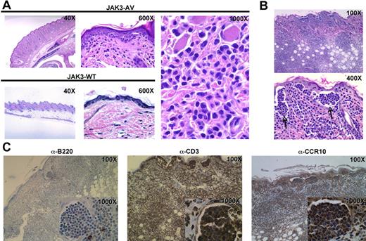 Figure 6. Constitutive JAK3 activation induces a T-cell lymphoproliferation with prominent cutaneous involvement. (A) H&E-stained skin tissue sections from JAK3-AV (top row and rightmost panel) or JAK3-WT (bottom row) animals showing a dense atypical dermal infiltrate comprised of pleomorphic lymphoid cells tagging along the dermal-epidermal junction in the former. (B) H&E-stained sections of skin lesions from secondary recipients display even more pronounced cutaneous disease, with significant involvement of the dermis and extension into subcutaneous adipose tissue. Sections of the epidermis highlight frequent collections of atypical intraepidermal lymphocytes resembling Pautrier microabcesses (indicated by). (C) Immunohistochemistry of skin sections from secondary recipients with anti-CD3 (left panel), anti-B220 (middle panel), or anti-CCR10 (right panel) antibodies. Insets show staining of intraepidermal lymphocyte collections highlighted in panel B.