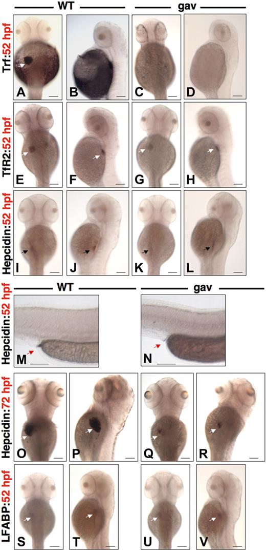 Figure 2. Phenotypic characterization of gavi. Whole mount in situ hybridization for transferrin-a (A-D), TfR2 (E-H), hepcidin (I-R), and LFABP (S-V) for WT siblings (A,B,E,F,I,J,M,O,P,S,T) versus gavIT029 (C,D,G,H,K,L,N,Q,R,U,V) in dorsal and lateral views at 52 hpf (A-N,S-V) and 72 hpf (O-R). White arrow indicates the liver. Black arrow indicates the foregut. Red arrow indicates the proctodeum (terminal gut). The scale bar represents 100 μm.