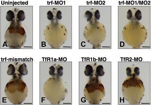 Figure 3. Effect of morpholino knockdown of transferrin-a or TfRs on o-dianisidine staining for hemoglobin at 48 hpf. Uninjected embryos (A) exhibited normal levels of hemoglobin, while morpholino knockdown of transferrin-a via injection of trf-MO1 (B) targeting the ATG, or trf-MO2 (C) targeting the exon 4 donor, or coinjection of trf-MO1/trf-MO2 (D) produced anemia. In contrast, coinjection of mismatch controls trf-MO1M/trf-MO2M (E) failed to produce anemia. Morpholino knockdown of the erythroid-specific transferrin receptor (TfR1a; F) resulted in anemia, while knockdown of the ubiquitously expressed transferrin receptor (TfR1b; G) or TfR2 (H) did not cause anemia. The scale bar represents 200 μm.