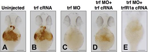 Figure 4. Coinjection of transferrin-a or TfR1a cRNA rescues anemia in transferrin-a morphants. O-dianisidine staining for hemoglobin at 48 hpf comparing (A) uninjected WT, (B) overexpression of transferrin-a cRNA, (C) morpholino knockdown of transferrin-a, (D) coinjection of transferrin-a cRNA with transferrin-a morpholino, (E) coinjection of TfR1a cRNA with transferrin-a morpholino. The scale bar represents 200 μm.