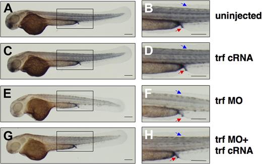 Figure 5. Coinjection of transferrin-a cRNA improves somite iron stores in transferrin-a morphants. DAB-enchanced Perl stain for ferric iron at 52 hpf in (A,B) uninjected WT, (C,D) transferrin-a cRNA overexpression, (E,F) morpholino knockdown of transferrin-a, (G,H) coinjection of transferrin-a cRNA with transferrin-a morpholino. Red arrow indicates the proctodeum. Blue arrow indicates the somites. The scale bar represents 200 μm.
