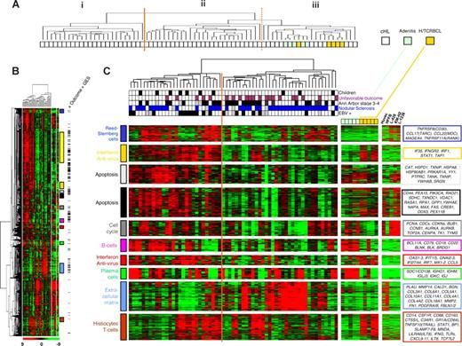 Figure 1. Global gene expression profiling of cHL samples and control samples. (A) The hierarchic clustering of all tissue samples analyzed using cDNA microarrays. The resulting dendrogram includes 63 lymph node tissue samples from cHL patients (white boxes), 5 from histiocyte/T cell–rich B-cell lymphoma (H/TCRBCL) patients (orange boxes), and 5 from benign lymphadenitis patients (green boxes). This clustering is based on the mRNA expression levels of 10 394 probe sets retained after a filtering process that removed probe sets with low and poorly measured expression as defined by an expression value inferior to 100 units in all 73 samples. Three major clusters of samples are observed and designated as I, II, and III. The heterogeneity of cHL samples is obvious. H/TCRBCL and benign lymphadenitis samples are grouped in cluster III and seem more homogeneous at the transcriptional level than cHL samples, although that could be due to their comparatively small number. (B) Hierarchic clustering restricted to cHL samples (n = 63) and based on 6229 probe sets with significant variation in mRNA expression levels across these samples. Each row represents a gene and each column represents a sample. The 2 separated color matrixes on the right correspond to the expression profile of control tissue samples (5 benign lymphadenitis, 5 H/TCRBCL samples, and 5 cell lines from left to right). Because these control samples are not considered in the clustering of cHL samples, genes are in the same order than in the major left matrix. The expression level of each gene in a single sample is relative to its median abundance across the 63 cHL tissue samples and is depicted according to a color scale (log2 scale) shown at the bottom. Red and green indicate expression levels, respectively, above and below the median. The magnitude of deviation from the median is represented by the color saturation. The dendrogram of cHL tissue samples (above matrix) represent overall similarities in gene expression profiles, whereas colored bars on the right indicate the locations of 11 gene clusters of interest. Black dashes on the right represent the 501 probe sets associated with clinical outcome according to the univariate Cox analysis (“Outcome” GES). A zoomed view of panel B is shown in panel C, highlighting the dendrogram and gene clusters. In the dendrogram (C, top) of cHL tissue samples, 2 large groups are evidenced by clustering and delimited by an orange vertical line. Below the dendrogram, relevant characteristics of cHL tissue samples are represented according to a color ladder (gray when unclassifiable or unavailable): age (adult, white; children, black), clinical outcome (favorable, white; unfavorable, purple), Ann Arbor stage (I-II, white; III-V, black), histologic type (nodular sclerosis, blue; mixed cellularity, white), and EBV tumoral status (negative, white; positive, black). The control samples are colored as in panel A. The 5 cell lines are HUVEC (endothelial cells), HFFB (fibroblastic cells), L-428, KM-H2, and L-1236 (Reed-Sternberg cells) (from left to right). Expanded views of selected gene clusters corresponding to relevant cell types/function are named from top to bottom: “Reed-Sternberg cells” (dark blue bar), “interferon pathway and antiviral response (1)” (orange bar), “apoptosis” (2 clusters; light gray and black bars), “cell cycle” (dark gray bar), “B cells” (pink bar), “interferon pathway and antiviral response (2)” (red bar), “plasma cells” (green bar), “extracellular matrix” (light blue bar), and “histiocytes/T cells/innate immune response” (brown bar). The “cell metabolism” cluster (yellow bar in B) is not zoomed in panel C. The most relevant genes included in these clusters are indicated on the right by their EntrezGene symbol.39