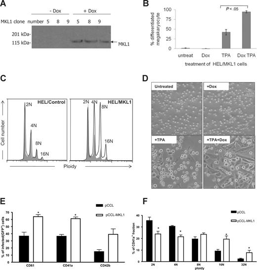 Figure 2. MKL1 promotes human megakaryocytic differentiation. (A) Validation of 3 HEL cell clones (clone numbers 5, 8, and 9) using Western blot analysis of MKL1 expression in the absence (left) and presence (right) of Dox for 2 days. MKL1-His protein is detected by anti-His antibody. (B) Based on analysis of Wright-Giemsa–stained cytospins, MKL1 increases the percentage of mature megakaryocytes in response to TPA over 4 days (P < .05). (C) Representative data showing ploidy of TPA-stimulated HEL/MKL1 cells or control cells after 4 days of differentiation with (solid line) or without (tinted) Dox. MKL1 increases the ploidy of cells exposed to TPA. Note increased 8N and 16N peaks in HEL/MKL1 cells. (D) Morphology of HEL cells treated with TPA and/or Dox as indicated. MKL1 has no effect on cell morphology in the absence of TPA (compare untreated with Dox), and promotes adhesion and spreading when cells are exposed to TPA (compare TPA with TPA + Dox). (E,F) The effects of enforced expression of MKL1 in human CD34+ cells during megakaryocytic differentiation. (E) The figures shown are gated for GFP-positive cells infected with pCCL and pCCL-MKL1 virus. Average percentage-positive cells for CD61, CD41a, and CD42b expression plus or minus SD of 3 independent experiments. *P < .05 from pCCL versus pCCL-MKL1 in the respective immunophenotype group. (F) Ploidy distribution of CD41a+ fraction in pCCL and pCCL-MKL1–infected cells plus or minus SD of 3 independent experiments. *P < .05 from pCCL versus pCCL-MKL1 in the respective ploidy group.