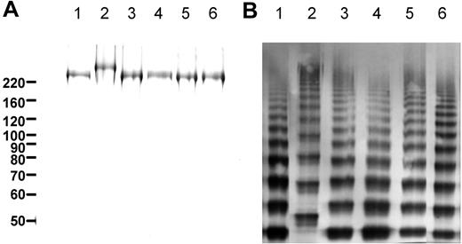 Figure 1. Purity and multimeric composition of VWF-CFP type 2N variants. (A) Purified VWF preparations were analyzed by sodium dodecyl sulfate–polyacrylamide gel electrophoresis under reducing conditions followed by silver staining. (B) Multimeric composition was analyzed by 2.5% agarose gel electrophoresis followed by Western blot analysis using rabbit polyclonal anti–human VWF. Lanes correspond with wild-type VWF-CFP (lane 1), Arg763Gly (lane 2), Thr791Met (lane 3), Arg816Trp (lane 4), Arg854Gln (lane 5), and Cys1060Arg (lane 6).