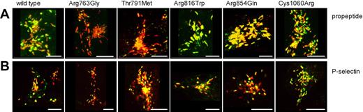 Figure 3. VWF-CFP type 2N variants induce the formation of storage organelles that recruit VWF propeptide and P-selectin in HEK293 cells. HEK293 cells were transfected with VWF-CFP type 2N variants alone (A) or in combination with P-selectin (B). Cells were stained for VWF propeptide (in green, A) using monoclonal antibody CLB-Pro17 and for P-selectin (in green, B) using rabbit polyclonal anti–human CD62P antibody. VWF-CFP type 2N variants are depicted in red (A,B). Shown is the merge of double-fluorescent detection of representative 3-dimensional projections (Z-stacks 0.4 μm). Regions of colocalization are shown in yellow. The scale bar represents 10 μm.