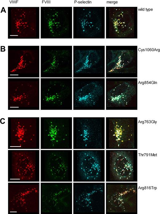 Figure 4. VWF-CFP type 2N variants induce formation of storage organelles that recruit both factor VIII-YFP and P-selectin. HEK293 cells stably expressing FVIII-YFP were transfected with P-selectin and wild-type VWF-CFP (A), P-selectin and VWF type 2N variants that display a moderately reduced binding to FVIII (Arg854Gln, Cys1060Arg) (B), or P-selectin and VWF type 2N variants that display a severely reduced binding to FVIII (Arg763Gly, Thr791Met, Arg816Trp) (C). Cells were stained for P-selectin using rabbit polyclonal anti–human CD62P antibody. Shown is triple fluorescent detection of representative 3-dimensional projections (Z-stacks 0.4 μm). VWF-CFP, FVIII-YFP, and P-selectin are shown in red, green, and blue, respectively. Triple fluorescent detection is shown in the color merges (regions of triple colocalization are shown in white). The scale bar represents 10 μm.