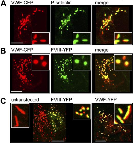 Figure 5. Factor VIII-YFP induces morphologic transition from elongated cigar-shaped structures to round circular-shaped organelles. (A) HEK293 cells were cotransfected with VWF-CFP and P-selectin. Cells were stained for P-selectin using rabbit polyclonal anti–human CD62P antibody. Shown is double-fluorescent detection of representative 3-dimensional projections (Z-stacks 0.4 μm). VWF-CFP, P-selectin, and regions of colocalization are shown in red, green, and yellow, respectively. The scale bar represents 10 μm. (B) HEK293 cells stably expressing FVIII-YFP were transfected with VWF-CFP. Shown is double-fluorescent detection of representative 3D projections (Z-stacks 0.4 μm). VWF-CFP, FVIII-YFP, and regions of colocalization are shown in red, green, and yellow, respectively. The scale bar represents 10 μm. (C) HUVECs were nucleofected with FVIII-YFP (left panel) or VWF-YFP (right panel). Endogenous VWF was stained using monoclonal antibody CLB-Rag35. Shown is the merge of double-fluorescent detection. Endogenous VWF is shown in red, FVIII-YFP (left panel) and VWF-YFP (right panel) are depicted in green, and regions of colocalization are yellow. The inset shows the morphology of vesicles. The scale bar represents 20 μm.