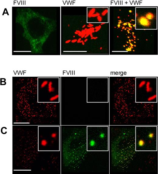 Figure 6. Morphology of Weibel-Palade bodies upon expression of untagged FVIII and VWF. (A) HEK293 cells were transfected with untagged FVIII (left panel), untagged VWF (middle panel), or both (right panel). Cells were stained for FVIII (green) using monoclonal antibody EL14 and for VWF (red) using monoclonal antibody CLB-RAg20. Shown is the merge of double-fluorescent detection of representative 3-dimensional projections (Z-stacks 0.4 μm). The scale bar represents 10 μm. (B) HUVECs (control) were transduced with untagged FVIII (C). Cells were stained for VWF (red, left panel) and FVIII (green, middle panel) using antibodies as in panel A. The right panel represents the merge of double-fluorescent detection. Regions of colocalization are represented in yellow. The scale bar represents 20 μm. The inset shows the vesicle morphology.