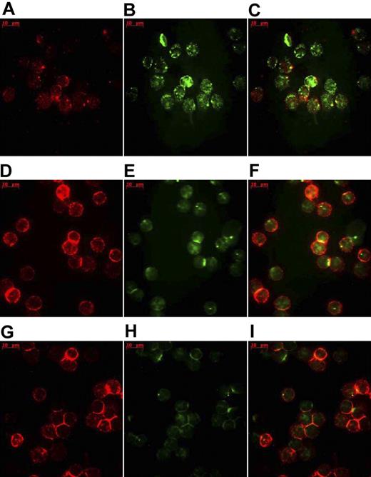 Figure 1. Analysis of sHSP70 uptake by T-cell subsets using fluorescent microscopy. Representative results of fluorescent microscopic images of isolated CD3+ and CD4+ T cells, respectively, incubated with sHSP70-FITC. CD3-PE–stained isolated CD3+ T cells (A) and isolated CD4+ T cells (D) and internalized sHSP70-FITC (B,E) are depicted separately, as well as with the merged images (C,F). Incubation of CD4+ T cells (G) with unlabeled sHSP70 resulted in a decrease of the uptake of the sHSP70-FITC as shown separately (H) and in the overlay (I).
