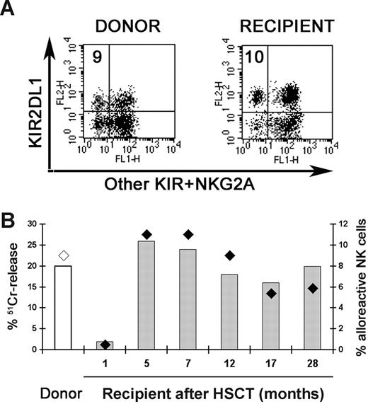 Figure 3. Alloreactive NK cells at various time points after transplantation. In case no. 11, characterized by C2 KIR-ligand mismatch and no activating KIR, the alloreactive NK cell subset was represented by cells expressing only KIR2DL1. (A) Staining with a mixture of EB6B-PE, DX9-FITC, CH-L-FITC, and Z199 followed by anti-IgG2b-FITC identified alloreactive NK cells, derived from the donor and the recipient (5 months after HSCT), in the top left quadrant (percent is indicated). (B) The specific lysis of BM15 B-EBV cell line expressing the homozygous haplotype HLA-A*0101, -B*4901 (Bw4), -C*0701 (C1) (columns) and the size of alloreactive NK subset (diamonds) were evaluated analyzing the NK cells derived from the donor (◇) and the recipient (♦) at different time points after transplantation. E:T ratio of 20:1 is shown.