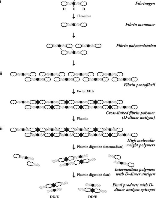 Figure 1. The stepwise process of Fibrin polymerization. The 3 major steps of D-dimer antigen formation are shown. (i) The fibrinogen molecule is cleaved by thrombin to produce fibrin monomers. These monomers associate with fibrinogen or fibrin to form protofibrils. They are held together by noncovalent forces shown as dotted lines between the intermolecular D-domain and D-E domains. (ii) Factor XIIIa formed by thrombin on fibrin polymers then covalently attaches D domains and inserts a covalent intermolecular linkage designated by the diamond-shaped figure. (iii) Plasmin must degrade fibrin at multiple sites to release fibrin degradation products, which then expose the D-dimer antigen epitope. The initial fragments are high-molecular-weight complexes followed by further degradation to produce the terminal D-dimer–E complex, which contains the dimer antigen. The 3 phases of this process are labeled on the right side of the diagram, and the different molecular forms of fibrinogen and its subsequent transformation by thrombin, factor XIIIa, and plasmin are shown on the left side of the diagram. This is a schematic representation of just one protofibril. Multiple protofibrils are aligned side by side and undergo branching to make a fibrin gel.