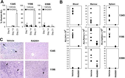 Figure 1. RAD001 inhibits ALL cell engraftment in NOD/SCID mice. NOD/SCID mice, injected with 3 to 5 × 106 cells from indicated xenografts, were treated with RAD001 starting 1 day after the injection of cells. (A) The percentage of human CD19+ cells (mean ± SD) in the PB at weekly bleeds of animals for each group is shown. (B) The total number of human CD19+ cells in the PB, BM, and spleen for each animal at death as determined by flow cytometry. The bar represents the mean of the group. (C) Infiltration of livers with human ALL. Hematoxylin and eosin staining was used. Arrows indicate ALL cells. Original magnification ×200 (details in “Histology”). Larger images are available in Figure S1.
