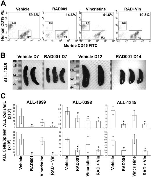 Figure 4. Reduction of ALL cells in the blood and spleens of mice engrafted with human ALL and treated with RAD001, vincristine, or the combination of both for 7 days. Mice engrafted with ALL-1999, -1345, or -0398 were treated with vehicle, RAD001, vincristine, or RAD001 plus vincristine for 7 days. (A) Representative flow cytometric analysis showing the percentage of human ALL cells in the PB of mice engrafted with ALL-1345. The percentage human ALL cells is shown. (B) Photographs of spleens recovered from mice engrafted with ALL-1345 after the indicated days of treatment with RAD001 or vehicle. (C) The absolute number of human ALL cells in the PB and spleens of mice treated as indicated are shown. Bars represent the mean plus or minus SD of groups of between 2 and 4 mice. *P < .05 compared with vehicle-treated animals.
