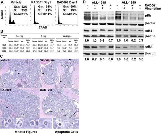 Figure 5. RAD001 arrests ALL cells in G0/G1 phase of the cell cycle. Mice were treated with vehicle, RAD001, vincristine, or RAD001 plus vincristine for 1 or 7 days. (A) ALL cells isolated from spleens were labeled with 7-amino-actinomycin D and analyzed by flow cytometry. Cell-cycle profiles of ALL-1345 are shown as representative examples. (B) The percentage of cells in each stage of the cell cycle after 1 day of treatment as indicated is shown. The mean plus or minus SD of the percentage of cells in each cell phase from replicate mice is shown (n ≥ 4). (C) Hematoxylin and eosin–stained sections from femurs of mice engrafted with ALL-0398 are shown with examples of mitotic () and apoptotic () figures. Original magnification ×200 (details in “Histology”). Higher-power examples of mitotic and apoptotic figures produced by a further 20× digital enlargement are shown below. Larger images available in Figure S3. (D) Effect of RAD001 and/or vincristine treatment on the phosphorylation status of Rb and the levels of cdks 4 and 6 after 1 day of treatment of NOD/SCID mice engrafted with ALL-1345 or ALL-1999. The numbers below the plots indicate the ratio of cdk4 and 6 to β-actin.