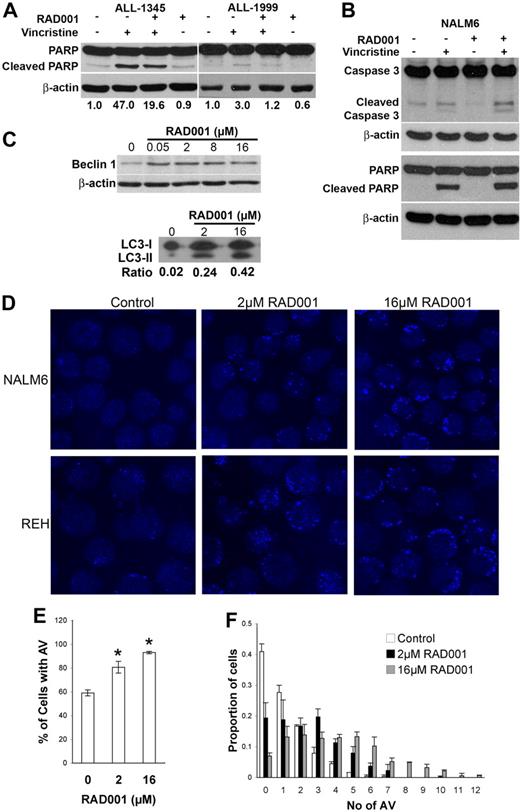 Figure 7. Mechanisms of cell death induced by RAD001 and vincristine alone and in combination. (A) Mice engrafted with ALL-1345 or ALL-1999 cells were treated with vehicle, vincristine, RAD001, or RAD001 plus vincristine for 24 hours and lysates prepared from recovered spleen cells. Lysates were subjected to Western blotting with anti-PARP, or anti–β-actin antibodies. (B) NALM6 cells were cultured with 2 μM RAD001, 1 nM vincristine, or the combination of both for 24 hours and cell lysates prepared. Lysates were subjected to Western blotting with anti-PARP, anticaspase 3, or anti-β-actin antibodies. (C) NALM6 cells were treated with the indicated doses of RAD001 for 24 hours, and cell lysates were analyzed for Beclin-1 and LC3 expression by Western blotting. β-actin is shown as a loading control for Beclin-1, and the ratio of LC3-II/LC3-I is indicated below the blots for LC-3. NALM6 or REH cells were treated with vehicle alone (Control), or 2 or 16 μM RAD001 for 24 hours. Cells were stained for acidic vacuoles using Lysosensor Blue. Representative fields of view are shown in panel D. Original magnification ×600. See “Immunofluorescence microscopy” for details. The proportion of cells containing acidic vacuoles (AV) (E) and the number of AV in each cell (F) are shown. Quantitation was obtained from the analysis of more than 120 cells for each condition in each of 2 separate experiments. The mean plus or minus SD of the independent experiments is shown for NALM6 cells.