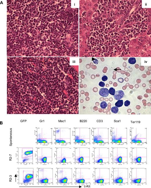 Figure 4. Leukemic cells are predominantly blastlike and Lin− Kit+. (A) Hematoxylin and eosin–stained histology sections of spleen (i), liver (ii), and BM (iii) from Runx2-induced leukemic mice. Wright-Giemsa staining of peripheral blood (iv) showing a predominant blastlike population () and a monocytic population (). (B) FACS analysis of GFP (expressed from MSCV-iresGFP), lineage markers (Gr1, Mac1, B220, CD3, Ter119), and progenitor marker (c-Kit) in spontaneous leukemia (top) and 2 Runx2-induced leukemia (R2-7, R2-3, middle and bottom).