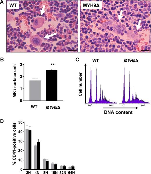 Figure 1. Megakaryocyte numbers are increased in MYH9Δ bone marrow. (A) Sections of WT and MYH9Δ bone marrow samples were stained with hematoxylin-eosin. Arrows indicate megakaryocytes; bars: 30 μm. (B) In situ quantification of megakaryocytes in the bone marrow by TEM. Values are the mean plus or minus sem for 3 mice, with 3 transversal sections examined per mouse. **P < .01 using the Student unpaired t test. (C) Ploidy distribution of CD41+ bone marrow cells in MYH9Δ and WT mice. The histograms show the distribution of DNA labeling and are representative of 4 mice. (D) Proportion of megakaryocytes in each ploidy class. Results are the mean plus or minus sem for 4 mice.
