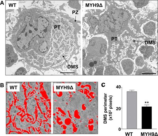 Figure 2. Abnormal morphology of mature MYH9Δ megakaryocytes. (A) TEM images illustrating a typical mature WT megakaryocyte (left) and an irregularly shaped MYH9Δ megakaryocyte (right) containing a dilated DMS that results in rare and enlarged platelet territories (PTs). Bars represent 5 μm. (B) Representative fields and threshold areas (red) of the DMS of WT and MYH9Δ megakaryocytes. (C) Quantification of the DMS by measurement of the perimeter per field of the threshold area. Data are expressed in pixels and are the mean plus or minus sem for 3 mice, with a total of 23 megakaryocytes analyzed. **P < .01 using Student unpaired t test.